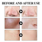 West & Month Blackhead Removing Mud Face Mask