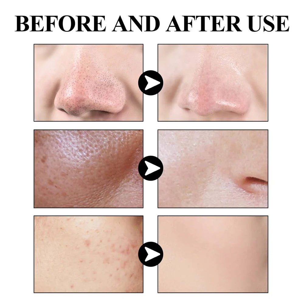West & Month Blackhead Removing Mud Face Mask