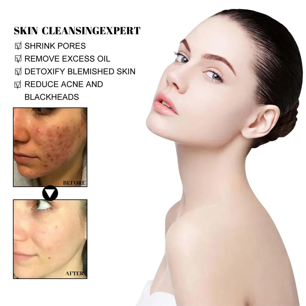 West & Month Blackhead Removing Mud Face Mask