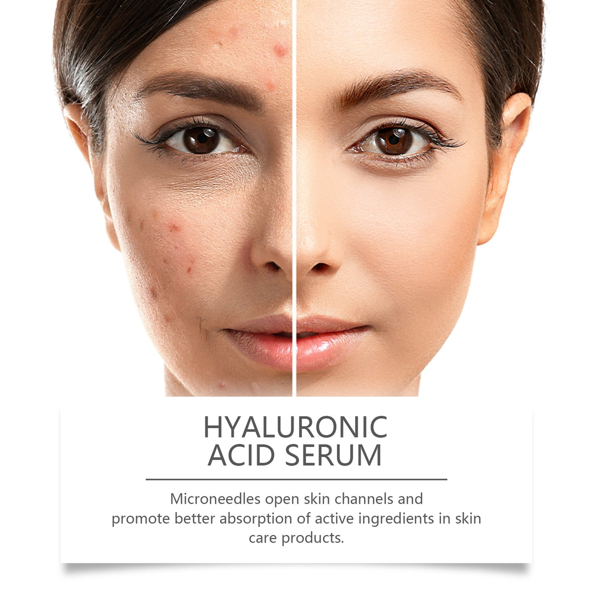 Hyaluronic Acid Face Serum for Skin Hydration Care