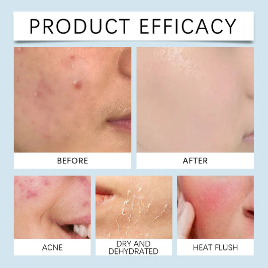 Hyaluronic Acid Face Serum for Skin Hydration Care