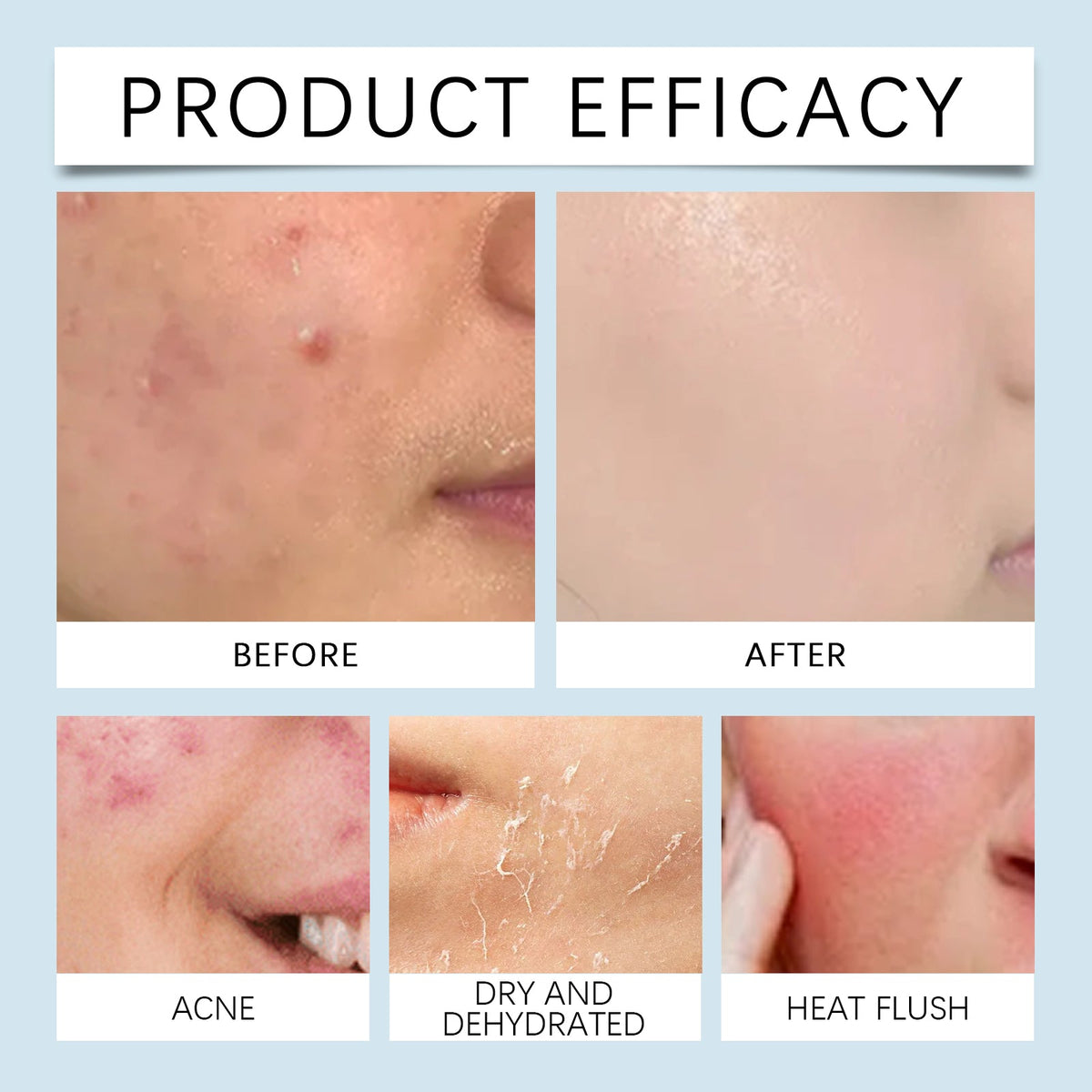 Hyaluronic Acid Face Serum for Skin Hydration Care